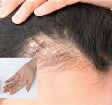 وصفة طبيعية تساعد على التخلص من مشكلة تساقط الشعر وإنباته مجددا