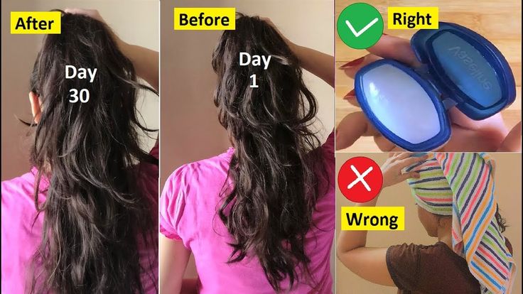 طريقة استخدام الفازلين لإطالة الشعر 2 سم في اليوم بنتيجة مضمونة ومذهلة