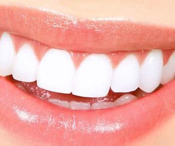 وصفات طبيعية للتخلص من بقع الأسنان الصفراء والبنية مجربة سهلة وغير مكلفة