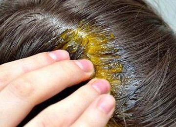 وصفة الثوم لعلاج تساقط الشعر نهائيا وبأسهل المكونات وأقل التكاليف