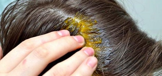 وصفة الثوم لعلاج تساقط الشعر نهائيا وبأسهل المكونات وأقل التكاليف