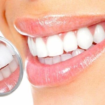 أسرع وصفة لتبيض الأسنان وجعلها لامعة مثل اللؤلؤ في دقيقتين فقط… والنتيجة ستبهرك!