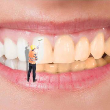 تبييض الأسنان في المنزل بمكونات طبيعية لا يعرفها الكثيرون قولي وداعاً للاصفرار والبقع