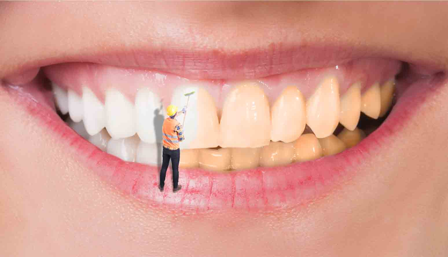 تبييض الأسنان في المنزل بمكونات طبيعية لا يعرفها الكثيرون قولي وداعاً للاصفرار والبقع