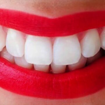 تبييض الأسنان في المنزل بـ 6 طرق مختلفة بمكونات طبيعية ستجعل أسنانك كاللؤلؤ من أول مرة