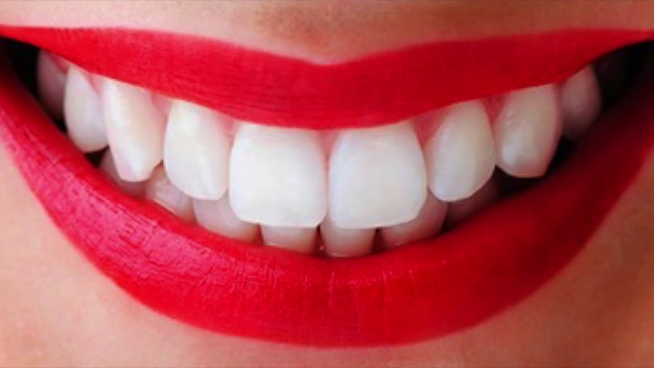 تبييض الأسنان في المنزل بـ 6 طرق مختلفة بمكونات طبيعية ستجعل أسنانك كاللؤلؤ من أول مرة