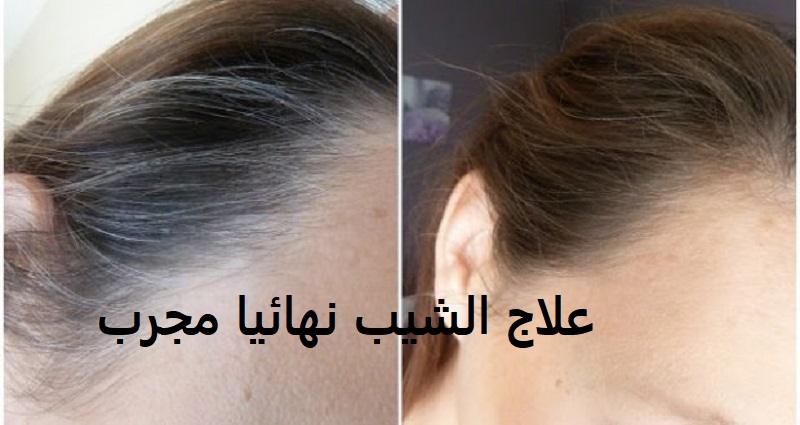 أهم علاج الشيب نهائيا مجرب وصفة مغربية لأجل التخلص من شيب الشعر للرجال والنساء