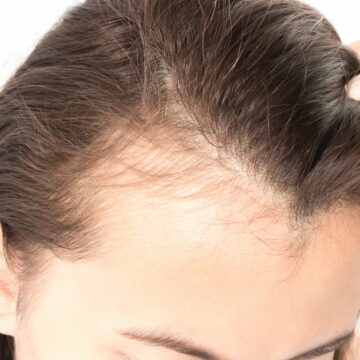 علاج تساقط الشعر طبيعيًا باستخدام الثوم والأعشاب ستجعل شعرك لامع وصحي وقوي