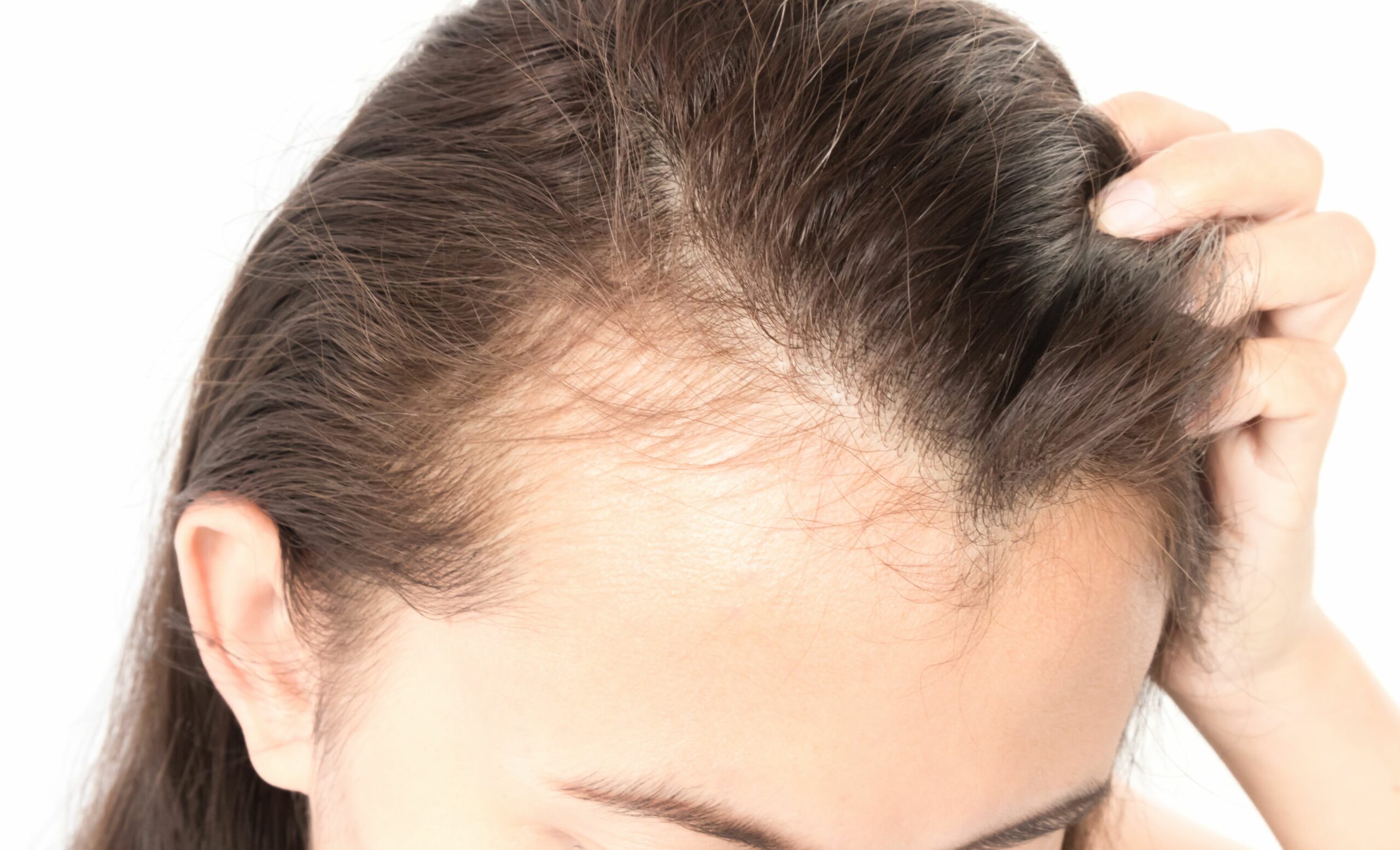 علاج تساقط الشعر طبيعيًا باستخدام الثوم والأعشاب ستجعل شعرك لامع وصحي وقوي