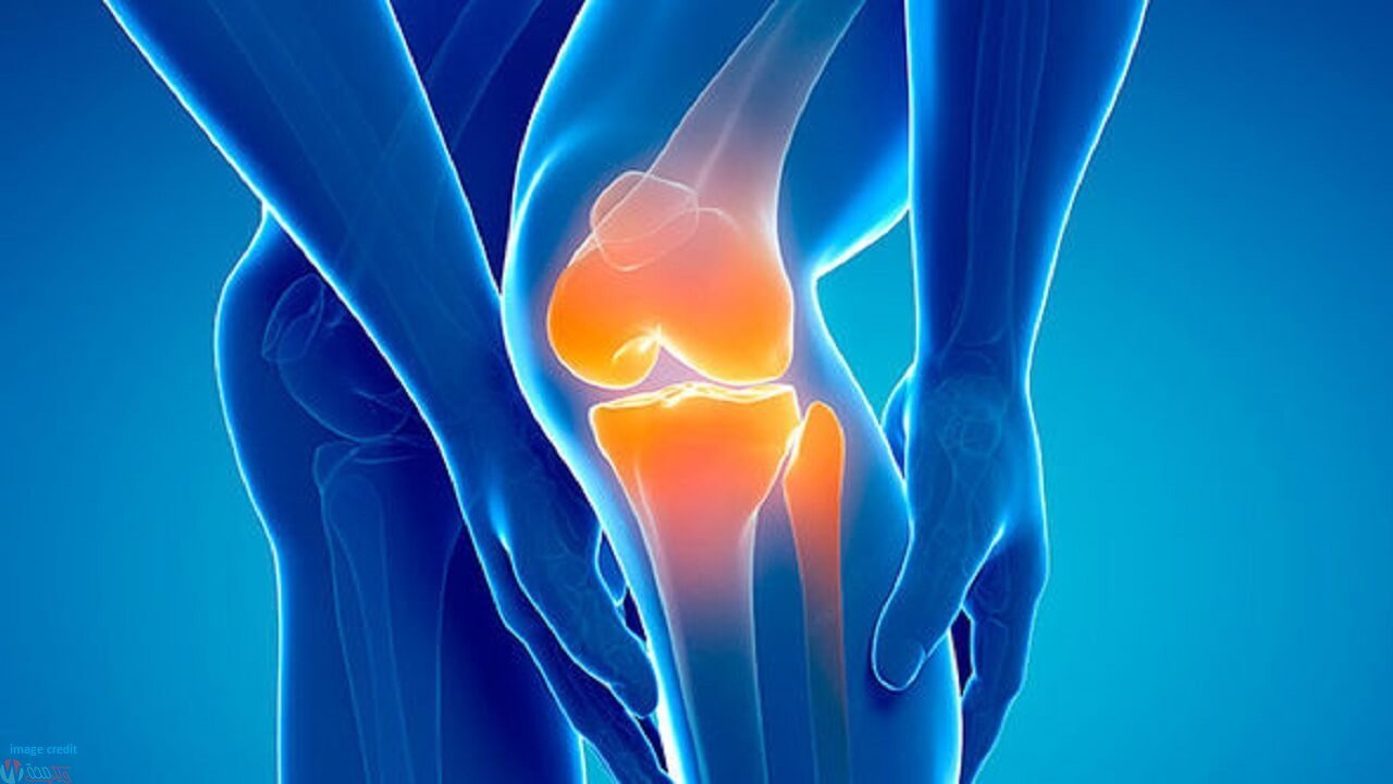 علاج خشونة الركبة بمكونات طبيعية من مطبخك دون الحاجة لأطباء وجراحة