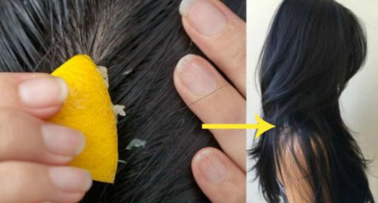 فوائد الليمون للشعر لا يمكن تصديقها من تفتيح لونه إلى تقويته وترطيبه كالحرير