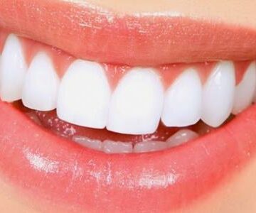 طرق منزلية لتبييض الأسنان باستخدام المكونات الطبيعية للحصول على ابتسامة جذابة 