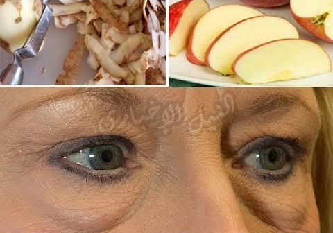 ماسك التفاح والبطاطس لعلاج التجاعيد والتخلص من خطوط البشرة المزعجة