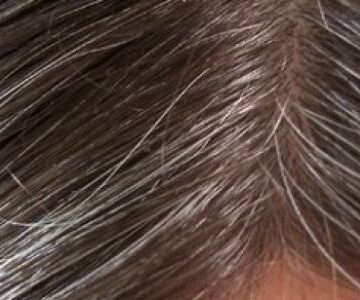 وصفات القرنفل للتخلص من الشيب المبكر والقضاء على الشعر الأبيض نهائياً في أسرع وقت