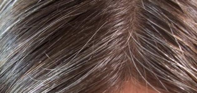 3 حلول نهائية ووصفات طبيعية لعلاج الشيب المبكر والتخلص من الشعر الأبيض من أهمها أوراق الكاري