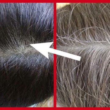 وصفات لعلاج شيب الشعر وزيادة إنتاج مادة الميلانين دون استخدام الصبغات 