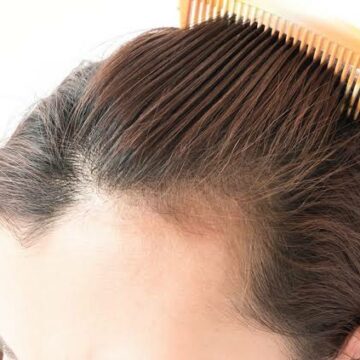 الحل النهائي في 7 أيام فقط لعلاج تساقط الشعر بماسك الجيلاتين الفعال لإعادة إنبات الفراغات