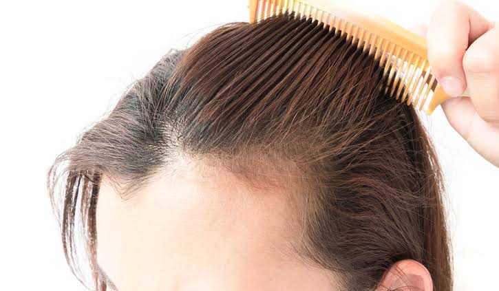 الحل النهائي في 7 أيام فقط لعلاج تساقط الشعر بماسك الجيلاتين الفعال لإعادة إنبات الفراغات