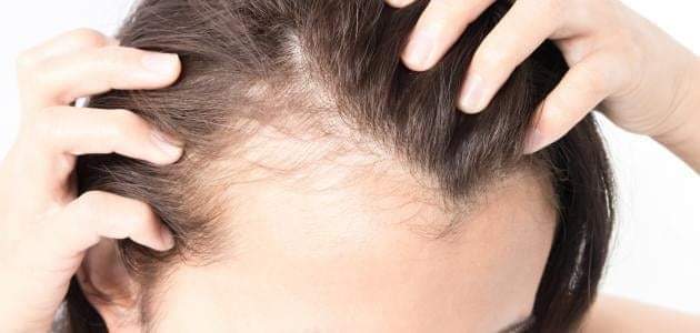 طرق طبيعية لإنبات الشعر… أقوى الوصفات لعلاج تساقط الشعر وإنبات فراغات بسرعة