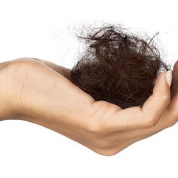 إيقاف تساقط الشعر في أسبوع الحل المضمون لمنع التساقط نهائيًا وتطويل شعرك
