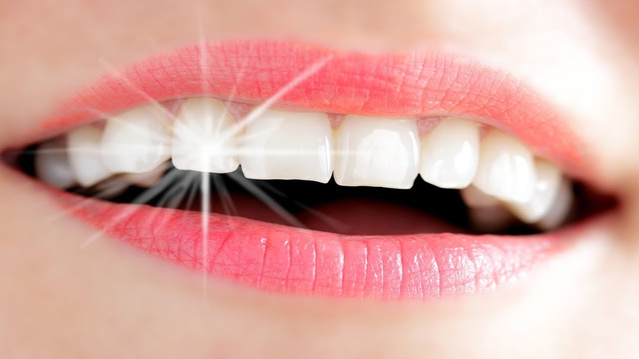 طريقة تبيض الأسنان بمكونات طبيعية من المنزل والنتيجة مضمونة