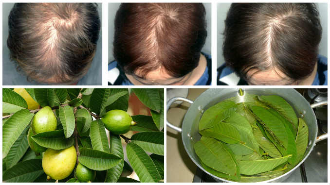 منقوع ورق الجوافة السحري لتطويل الشعر ومنع تساقط الشعر في أسبوع واحد فقط
