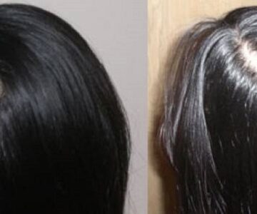 طرق طبيعية لعلاج فراغ الشعر بالأعشاب وأفضل الوصفات الطبيعية لإنبات الشعر مرة أخرى