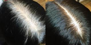 وصفة للقضاء على شيب الشعر بشكل نهائي باستخدام فيتامين سي لعلاج الشيب فورياً
