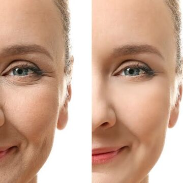 بروتين طبيعي بمكونات في منزلك لإزالة تجاعيد الوجه والحصول على بشرة شابة كأنك في الـ 20 من عمرك