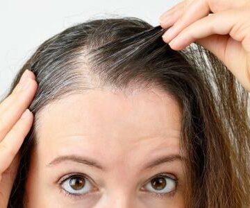وصفات وطرق طبيعية تساعد على إزالة الشعر الأبيض والتخلص من علامات الشيب المبكر