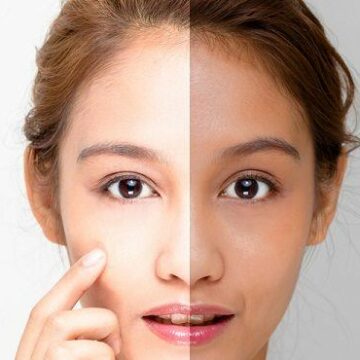 طرق تبييض الوجه في وقت قياسي والحصول على بشرة فاتحة وأكثر نضارة باستخدام وصفات طبيعية