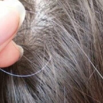 ثلاثة طرق للتخلص من الشعر الأبيض بشكل نهائي بوصفات طبيعية بالكامل والقضاء على الشيب المبكر