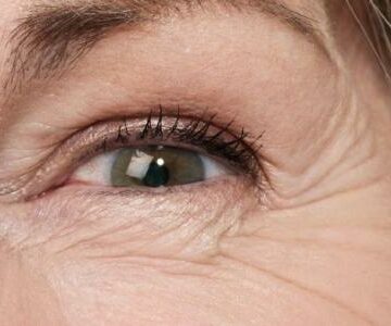 طريقة التخلص من التجاعيد والخطوط الدقيقة حول العين بمكونات طبيعية آمنة على البشرة