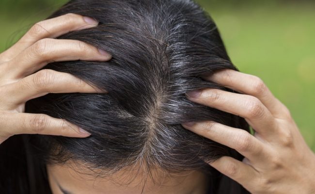 خلطة الملح لعلاج شيب الشعر نهائيا وللابد بدون رجوعة مرة أخرى