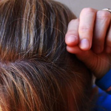 اسباب وعلاج شيب الشعر الابيض بدون صبغات كيميائية