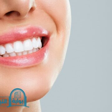 6 طرق منزلية لتبييض الأسنان الصفراء وأسبابها ونتائج مبهرة لعلاجها
