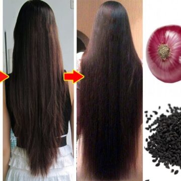بصلة وثومة سر تطويل الشعر اعرفي كيفية تطبيق الوصفة على شعرك وهيطول أكثر من اللازم