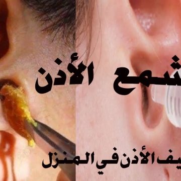 بتتألم كل ما بتنظف أذنك وما بتعرف كيف تغسلها … إليك أسهل طريقة لتنظيف الأذن من الشمع خلال دقائق